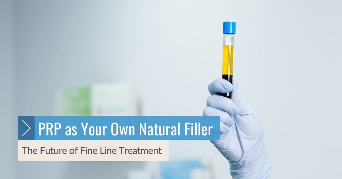 PRP Fine Line Treatment at Nichola Maasdorp No4 Clinic in Elgin, Moray, Scotland